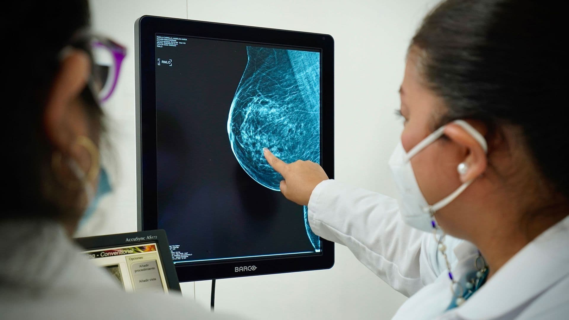 Detección temprana del cáncer de mama