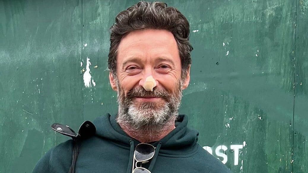 Hugh Jackman Anuncia que No Tiene Cáncer de Piel