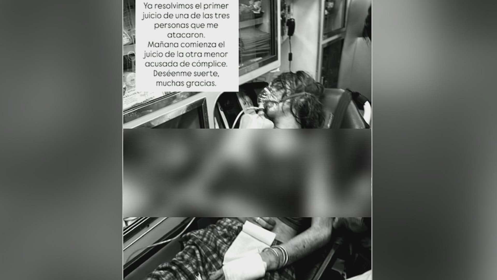 Valentina Gilabert Revela Foto de Momentos Después de que Fue Apuñalada Más de 15 Veces