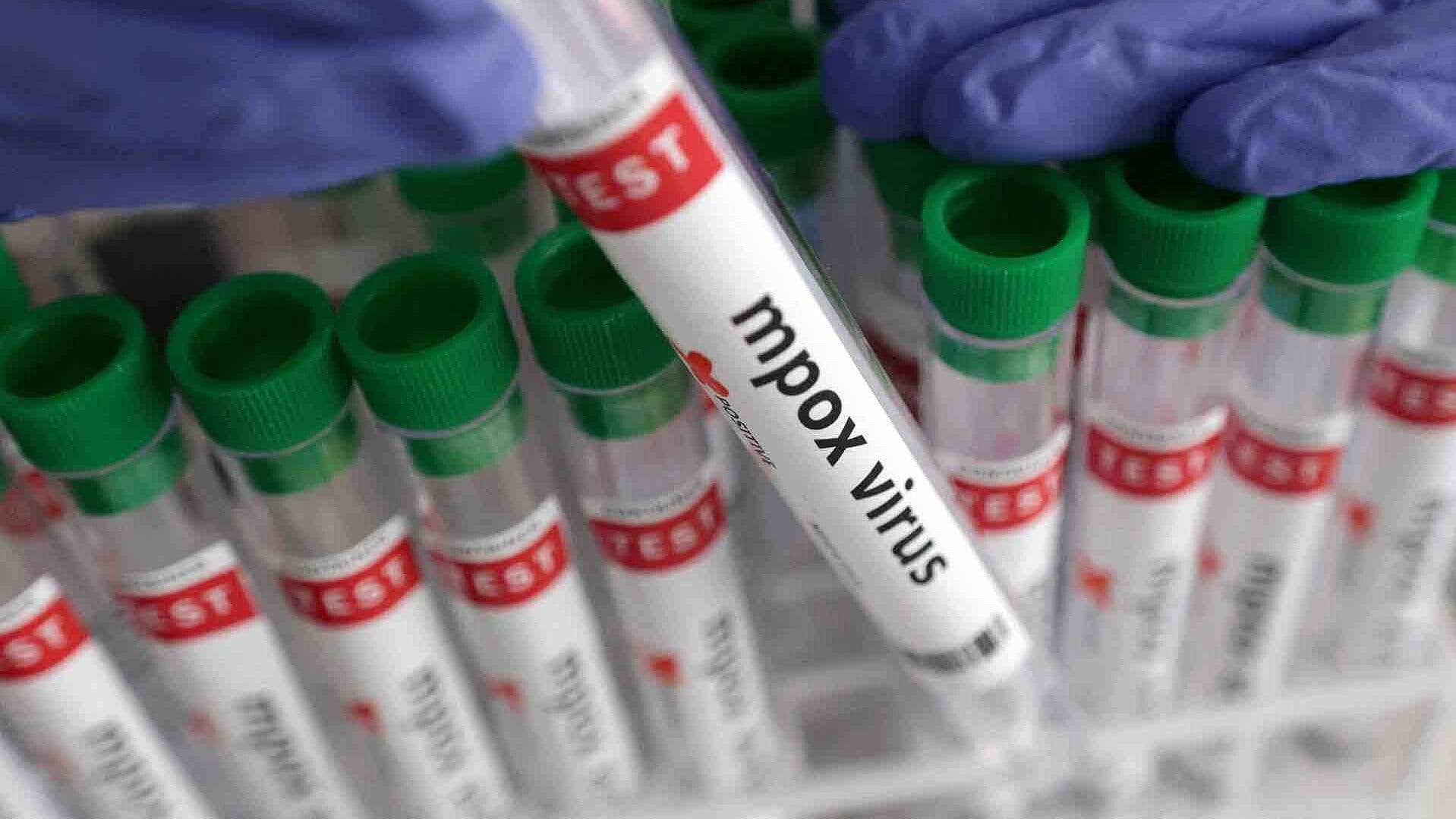 Nueva Alerta Sanitaria por Brote de Mpox en Congo