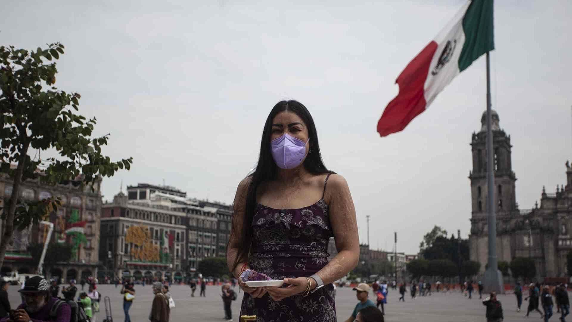 Saxofonista María Elena Ríos: A Cinco Años del Ataque con Ácido