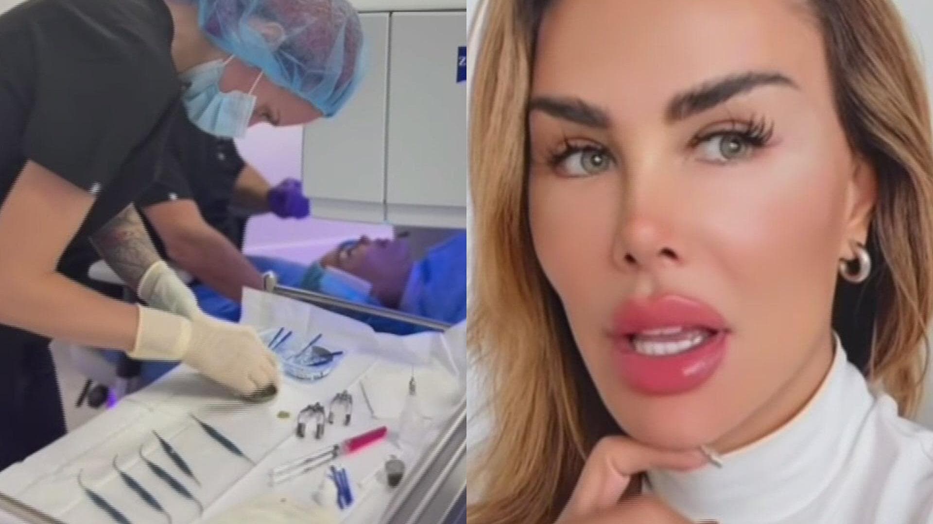 Ninel Conde Cambia el Color de sus Ojos ¿Cuánto le Costó la Cirugía?