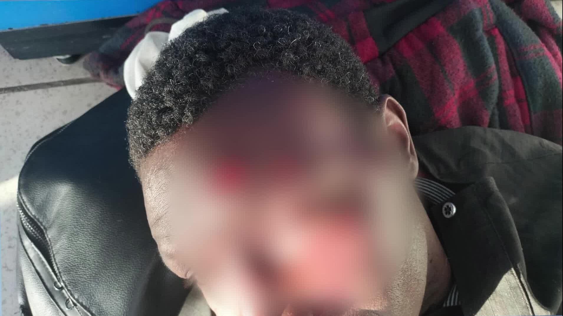 Migrante de Senegal Cae de Tren en Movimiento Sobre Carretera San Luis