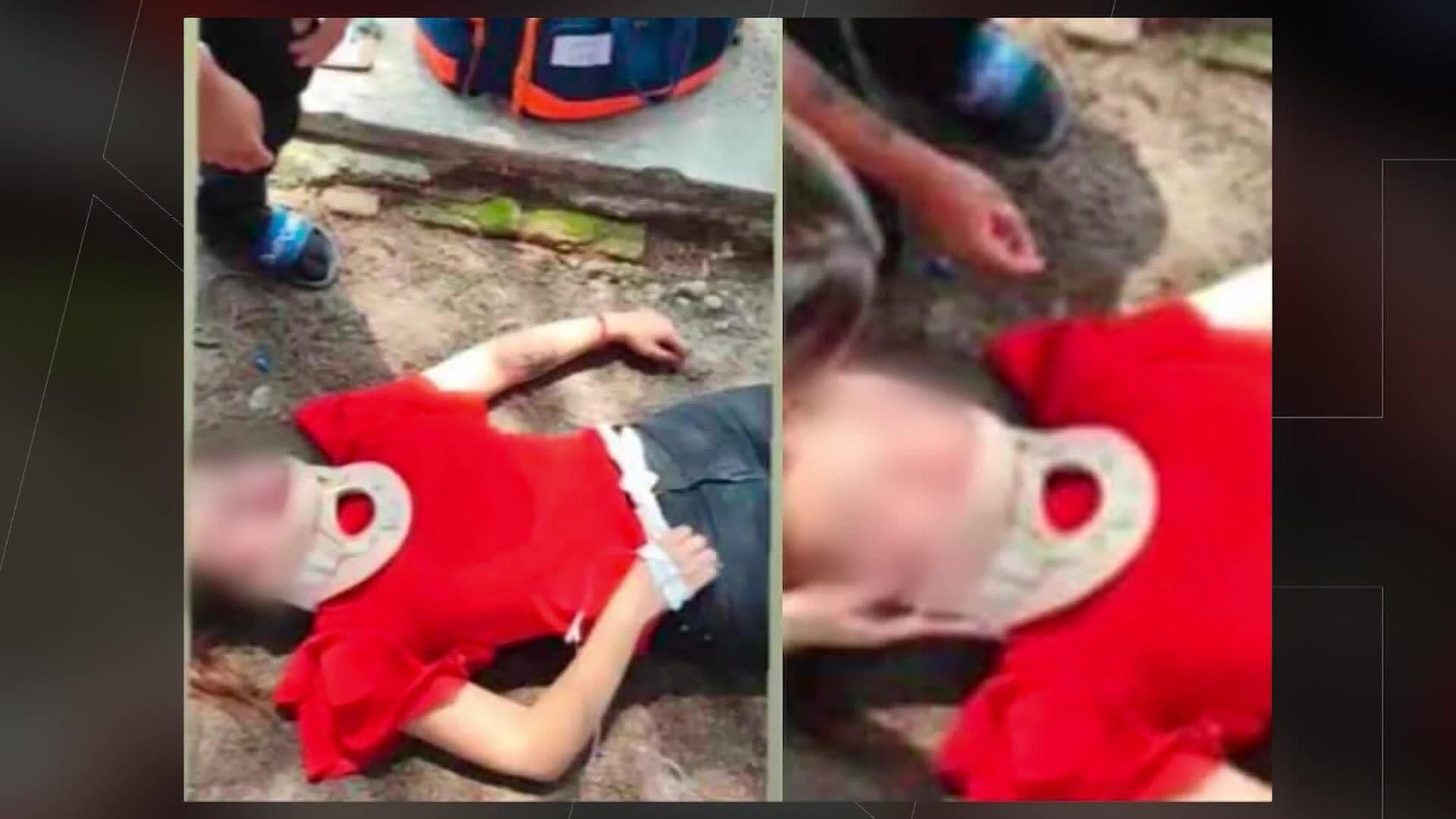La Joven Agredida Por Estudiantes de UdeG, En Poncitlán, Podría Perder Un Ojo