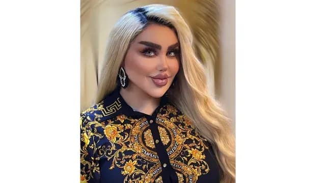 Barbie Iraquí con más de 40 cirugías