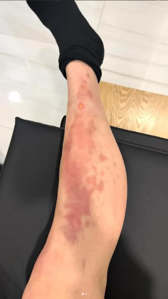 Taylor-Momsen-Asi-Quedo-Pierna-Araña-Mexico