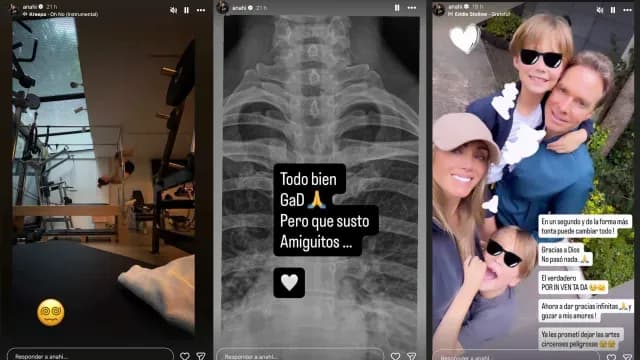anahi caida pilates imagenes accidente