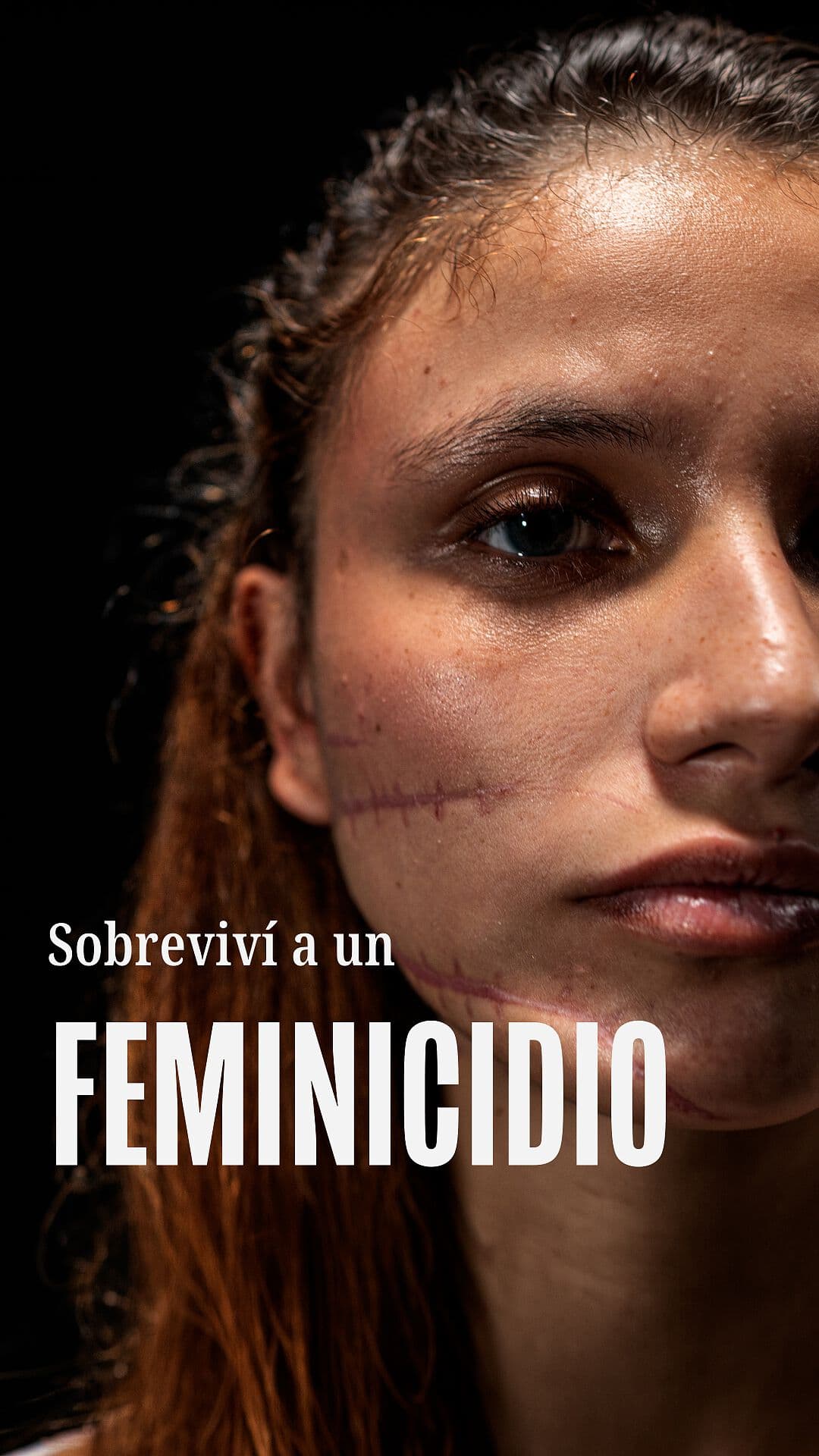 Sobreviví a un Feminicidio
