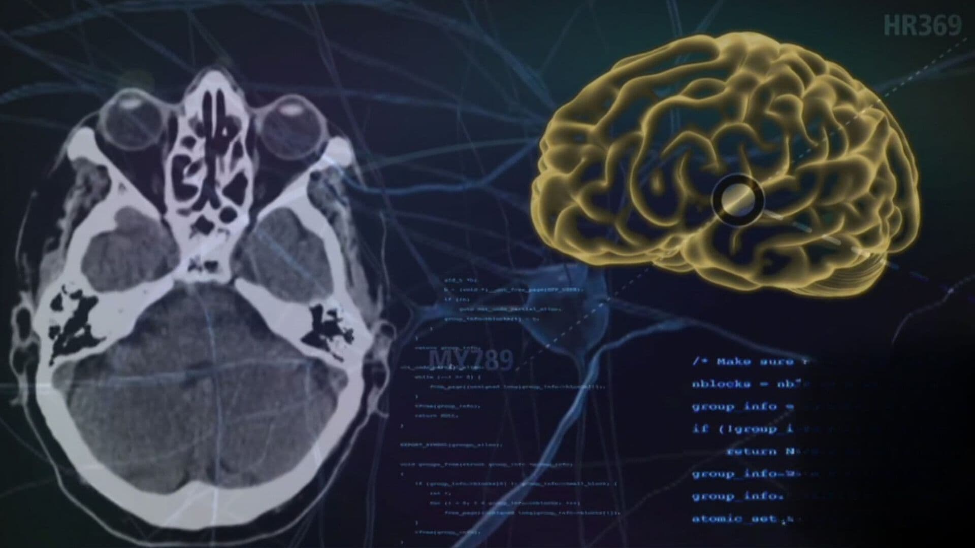 Unesco Lanza Primera Norma Mundial sobre Ética de Neurotecnología