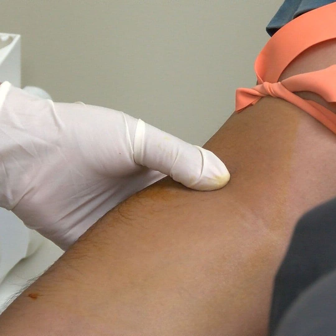 Piden Donaciones de Sangre para Mantener Abasto en Hospital General de Tijuana