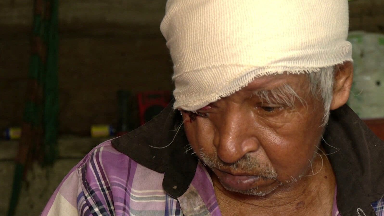 Empeora Salud de Filemón Morales, Afectado por Gusano Barrenador en Chiapas