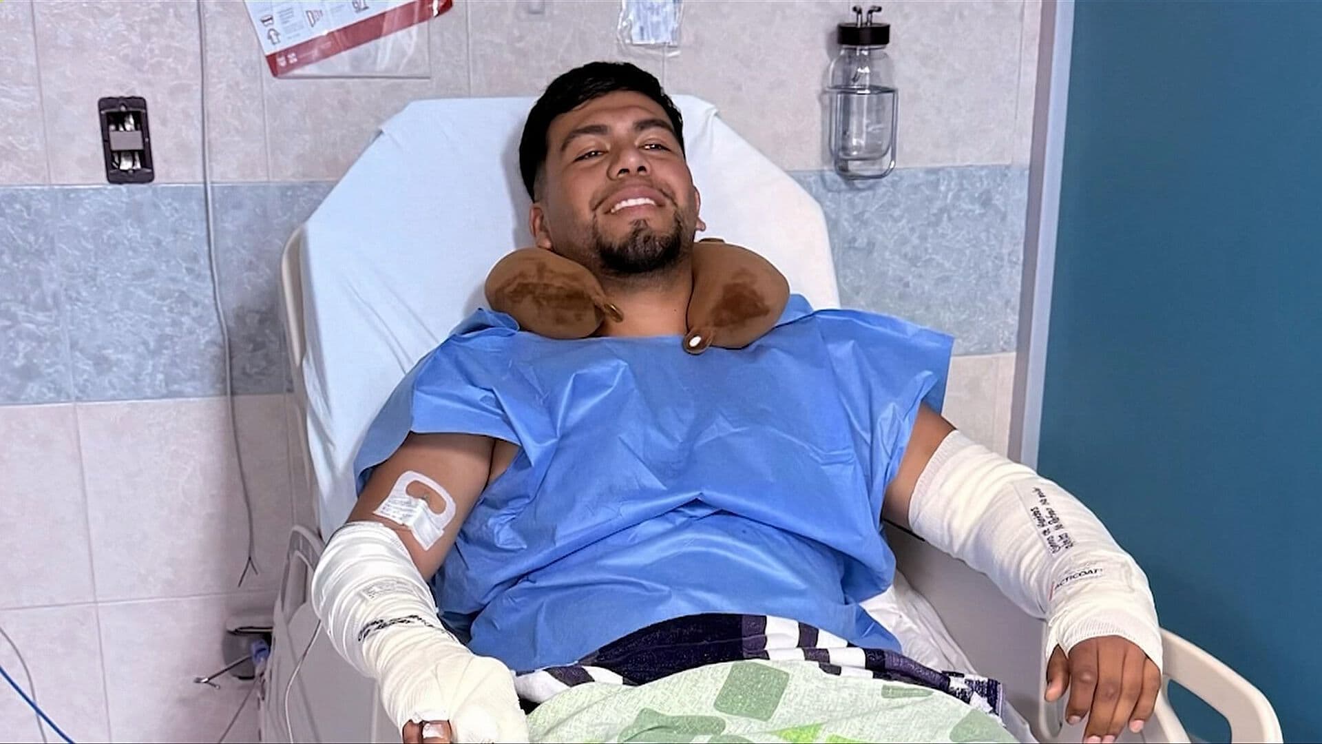 Juan Luis Ve sus Brazos y Recuerda Cómo Pasó la Explosión de La Concordia