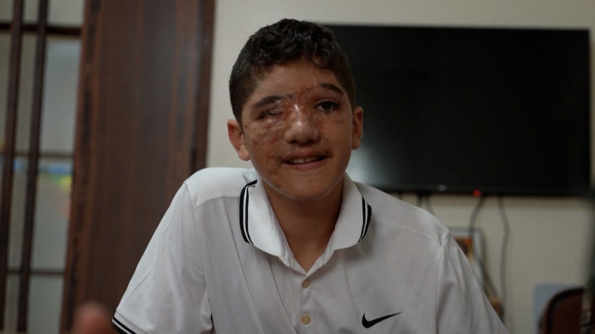 Joven que Perdió un Ojo en Ataque Israelí se Recupera