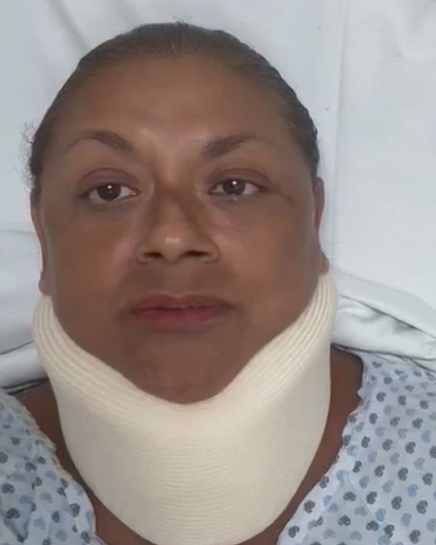 Reportera Atropellada Relata Cómo Ocurrió Accidente