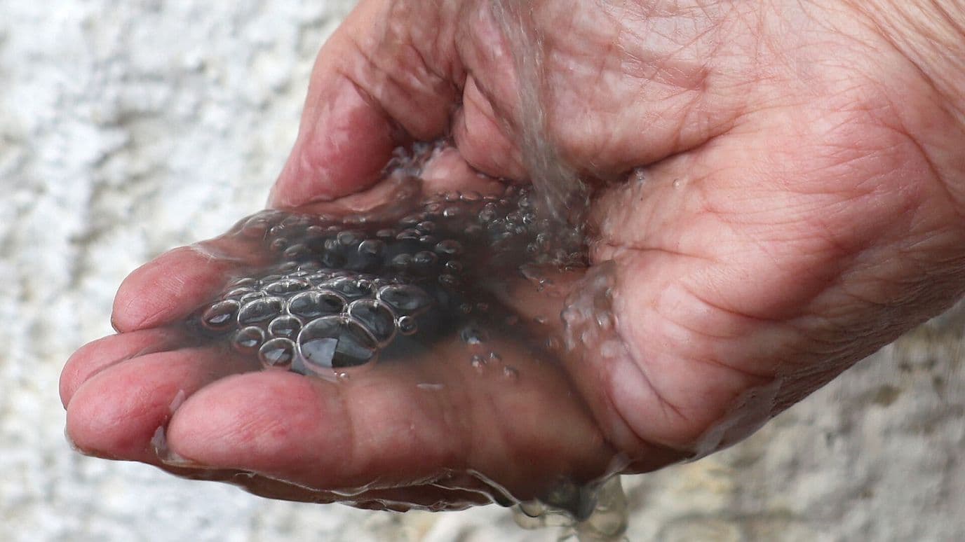 'Todo el Tiempo me Estoy Rascando': Agua Sucia de Guadalajara
