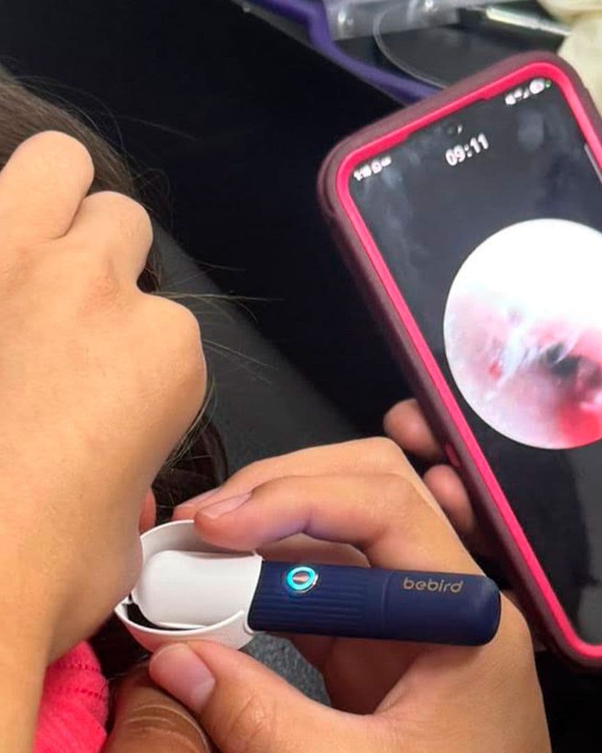 Una niña de 4 años en Acuña, Coahuila, sufría un dolor de oído que resultó ser un ciempiés.