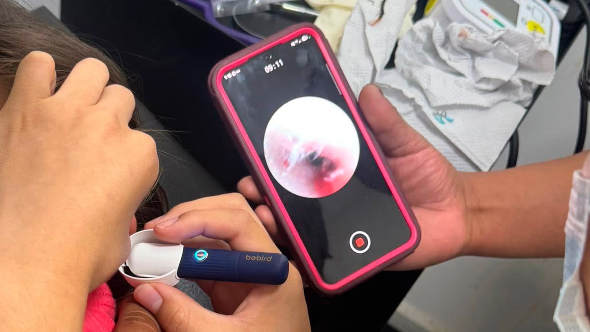 Una niña de 4 años en Acuña, Coahuila, sufría un dolor de oído que resultó ser un ciempiés.