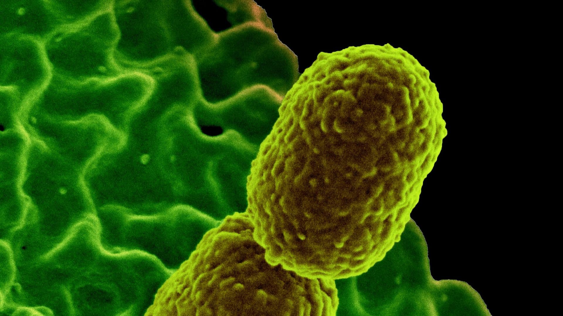 Bacteria Klebsiella, vinculada a la muerte de bebés en el IMSS
