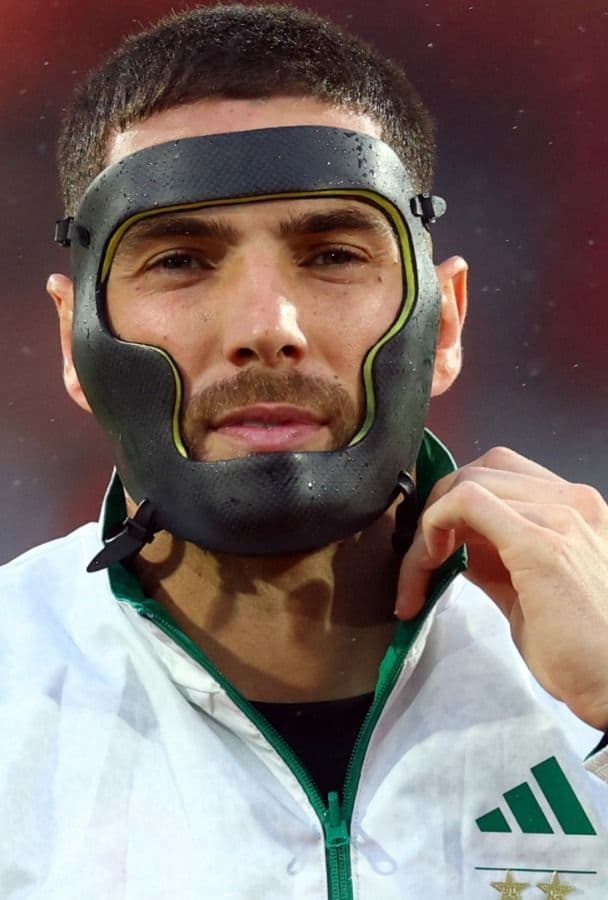 ¿Por qué Luca Zidane usa una máscara negra?