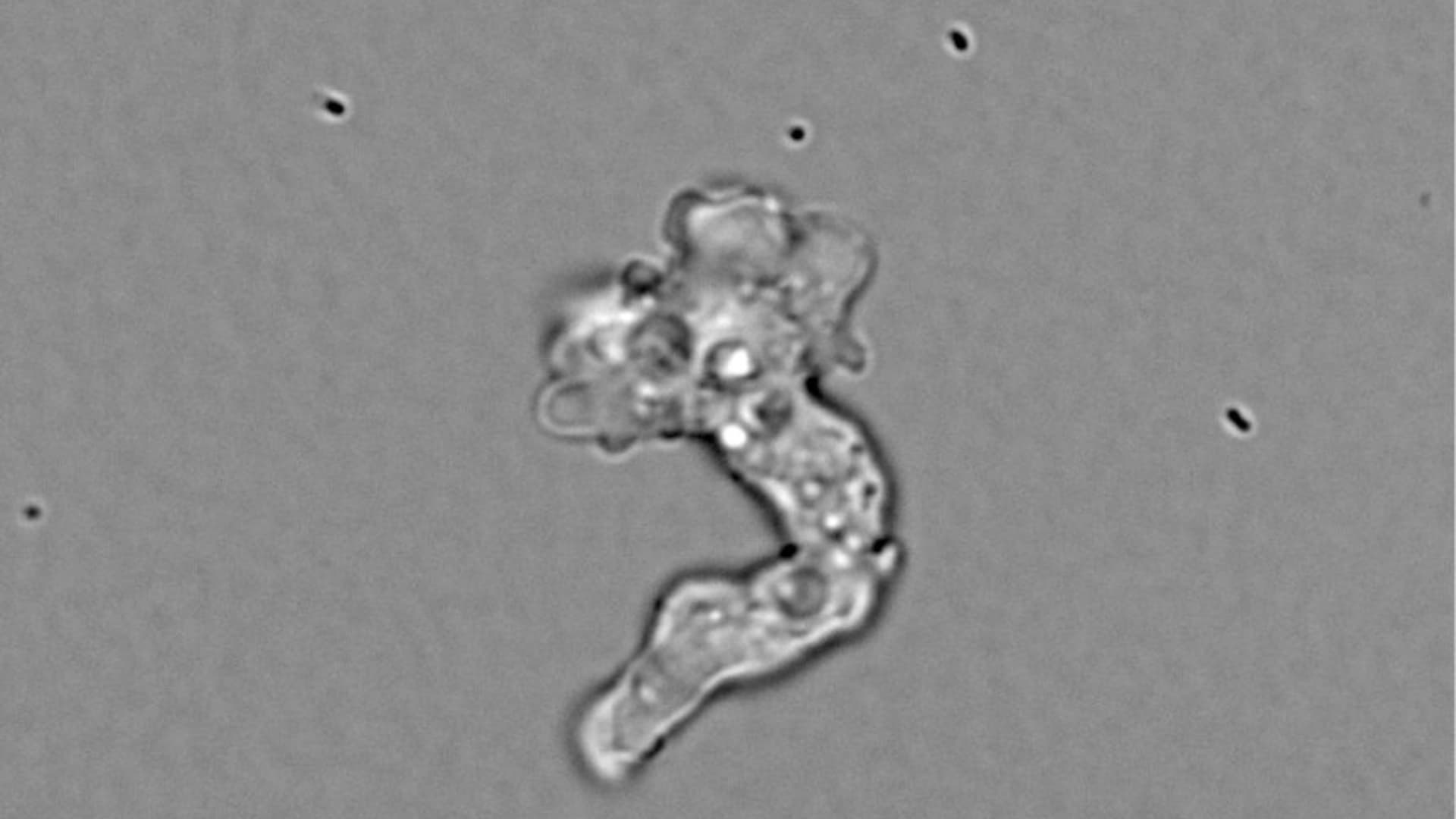 Científica Descubre Dos Nuevas Especies de Ameba en Laboratorio Improvisado en un Motel