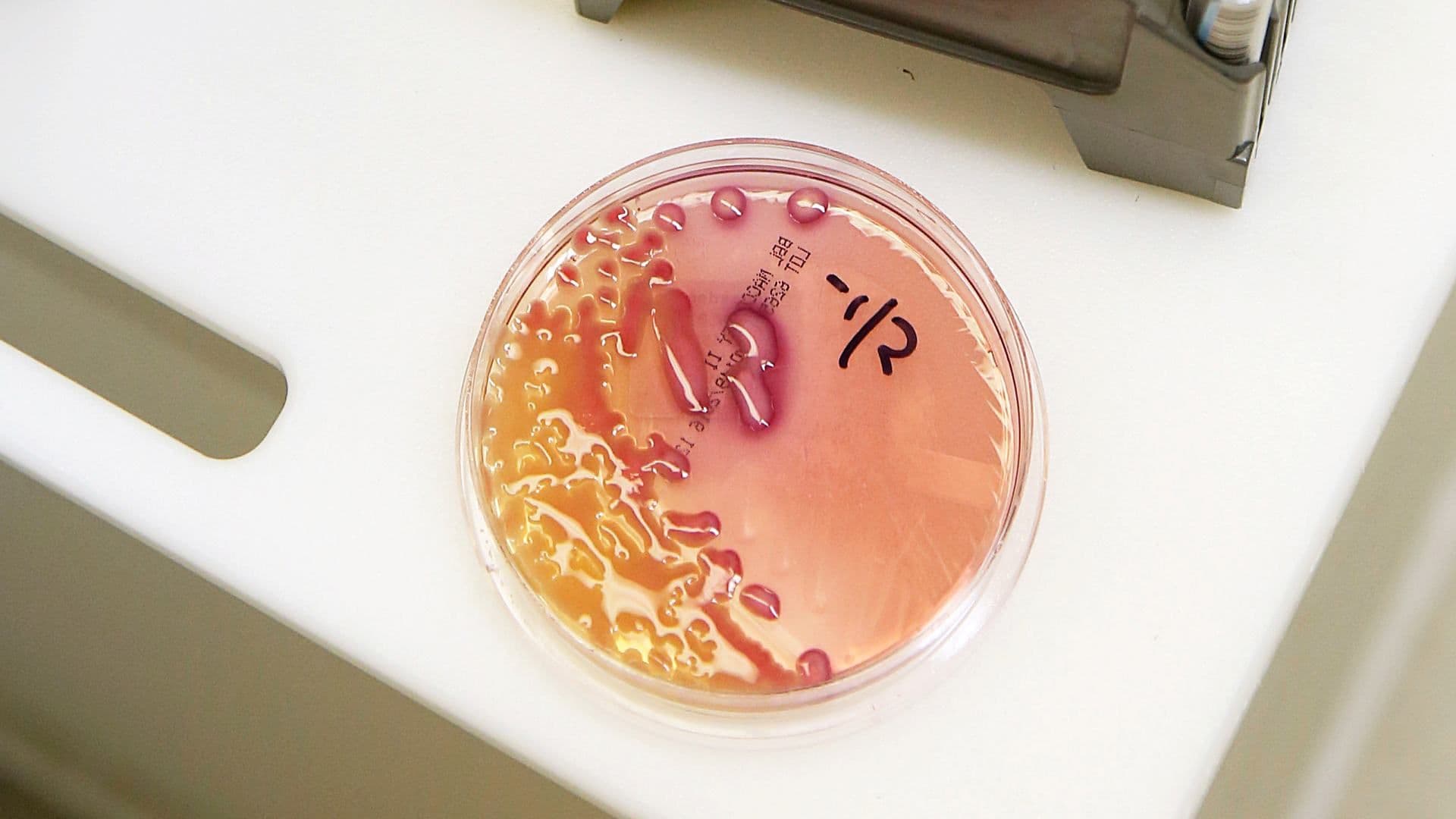 Klebsiella pneumoniae en el laboratorio del Berkeley Medical Center en Virginia Occidental, en diciembre 2016. Foto: Reuters | Archivo