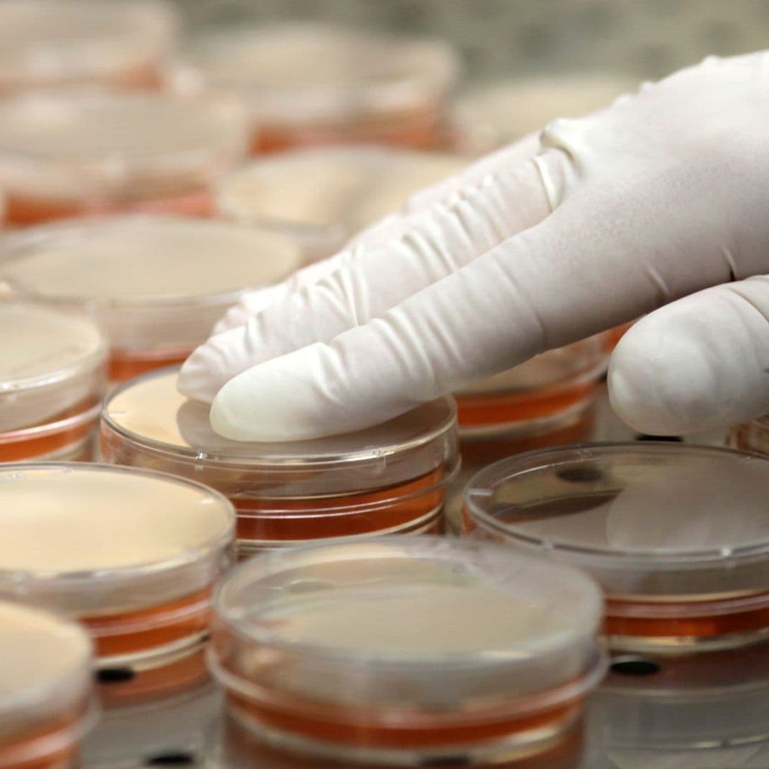 Súper Bacteria Mortal También se Aloja en Alimentos y Agua: Esto Descubrió Investigador