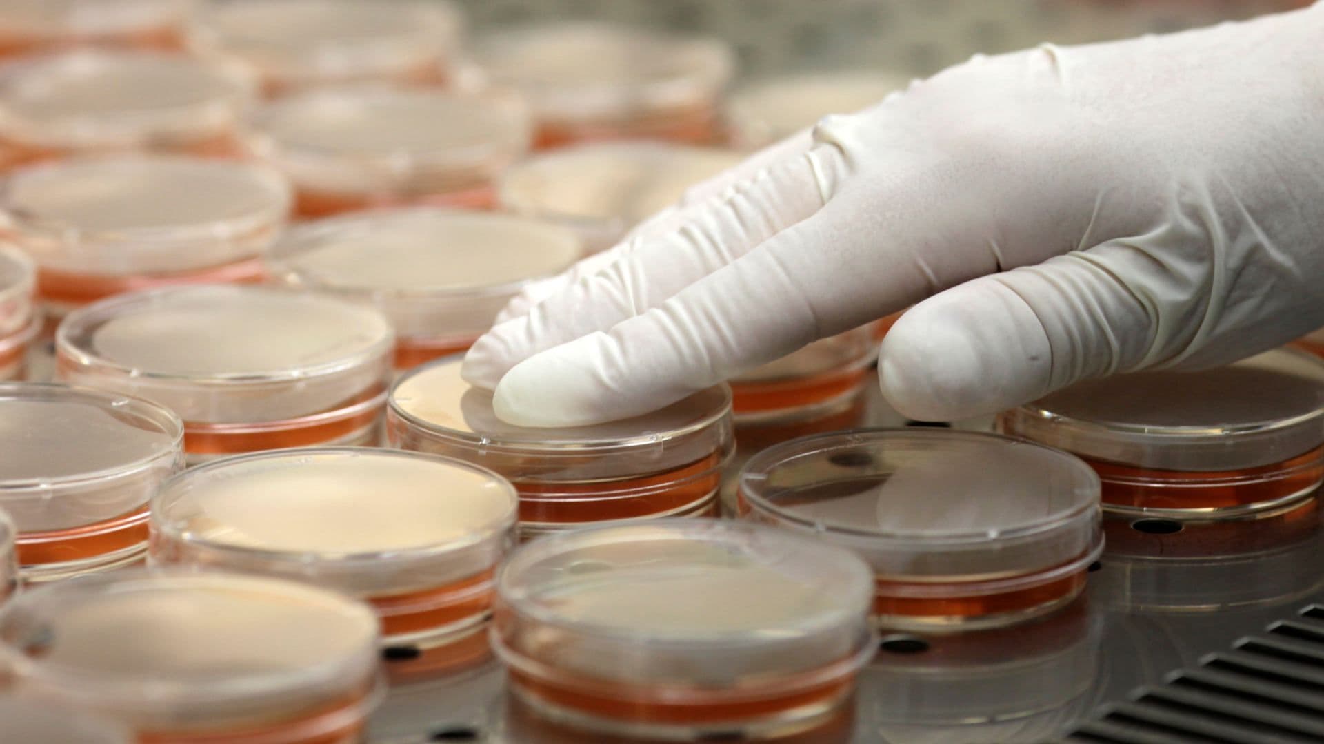 Especialista prepara placas de Petri para un análisis de bacteria en Riga, en junio 2011. Foto: Reuters | Archivo
