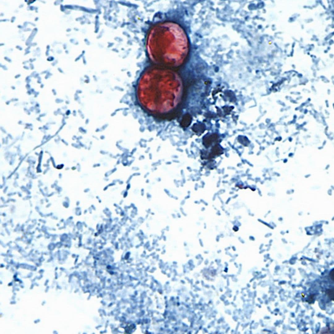 Muestra de Cyclospora cayetanensis, diarrea explosiva