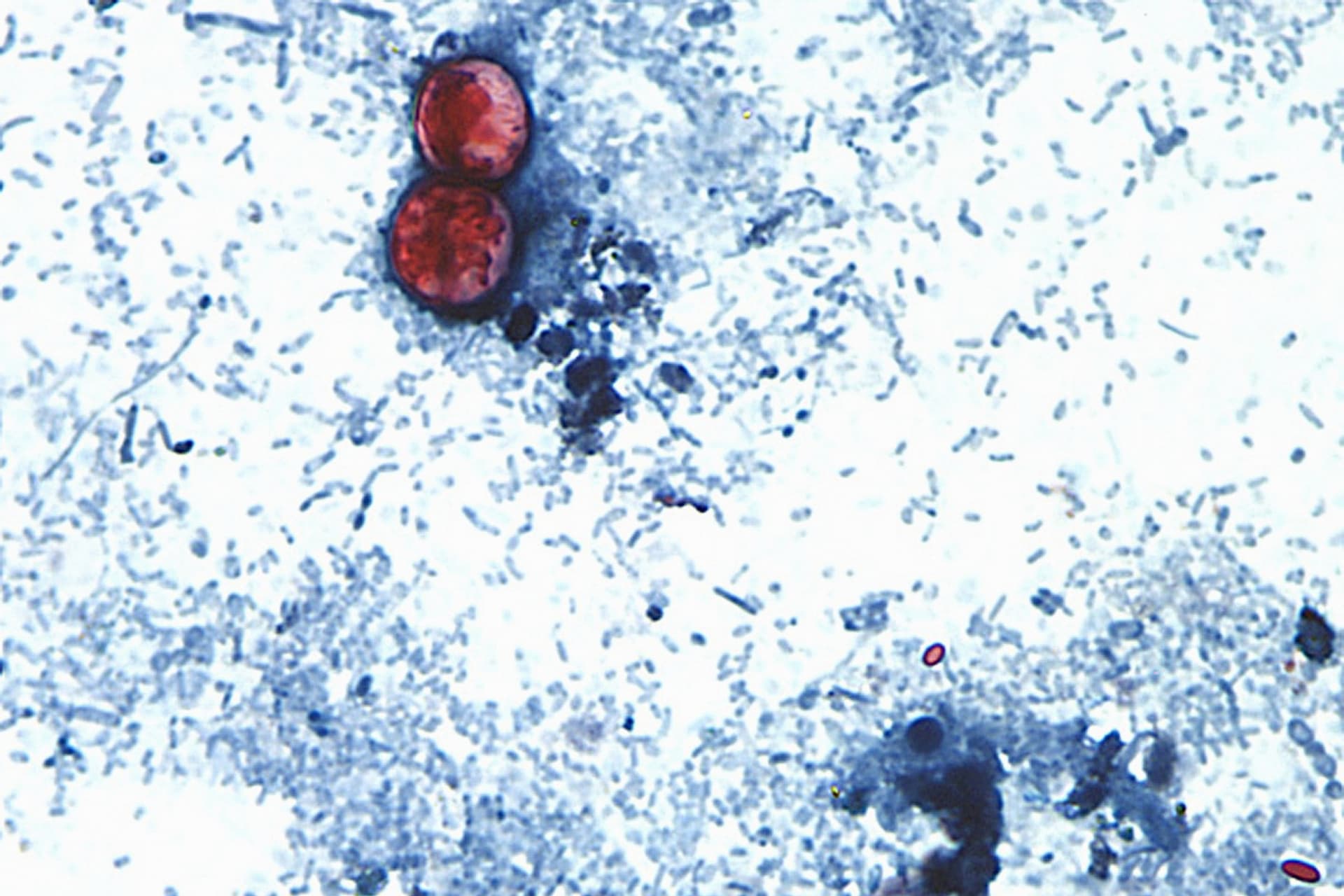 Muestra de Cyclospora cayetanensis, diarrea explosiva