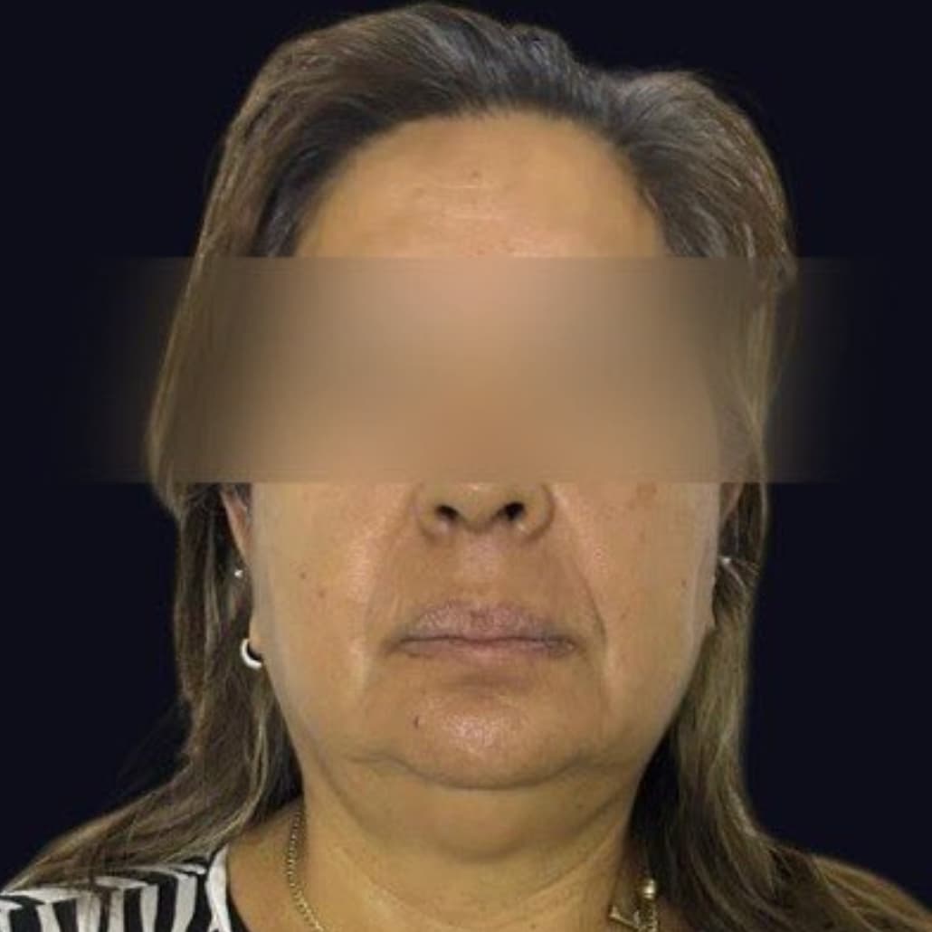 Alicia "N" fue detenida por hacerse pasar por doctora en Querétarop