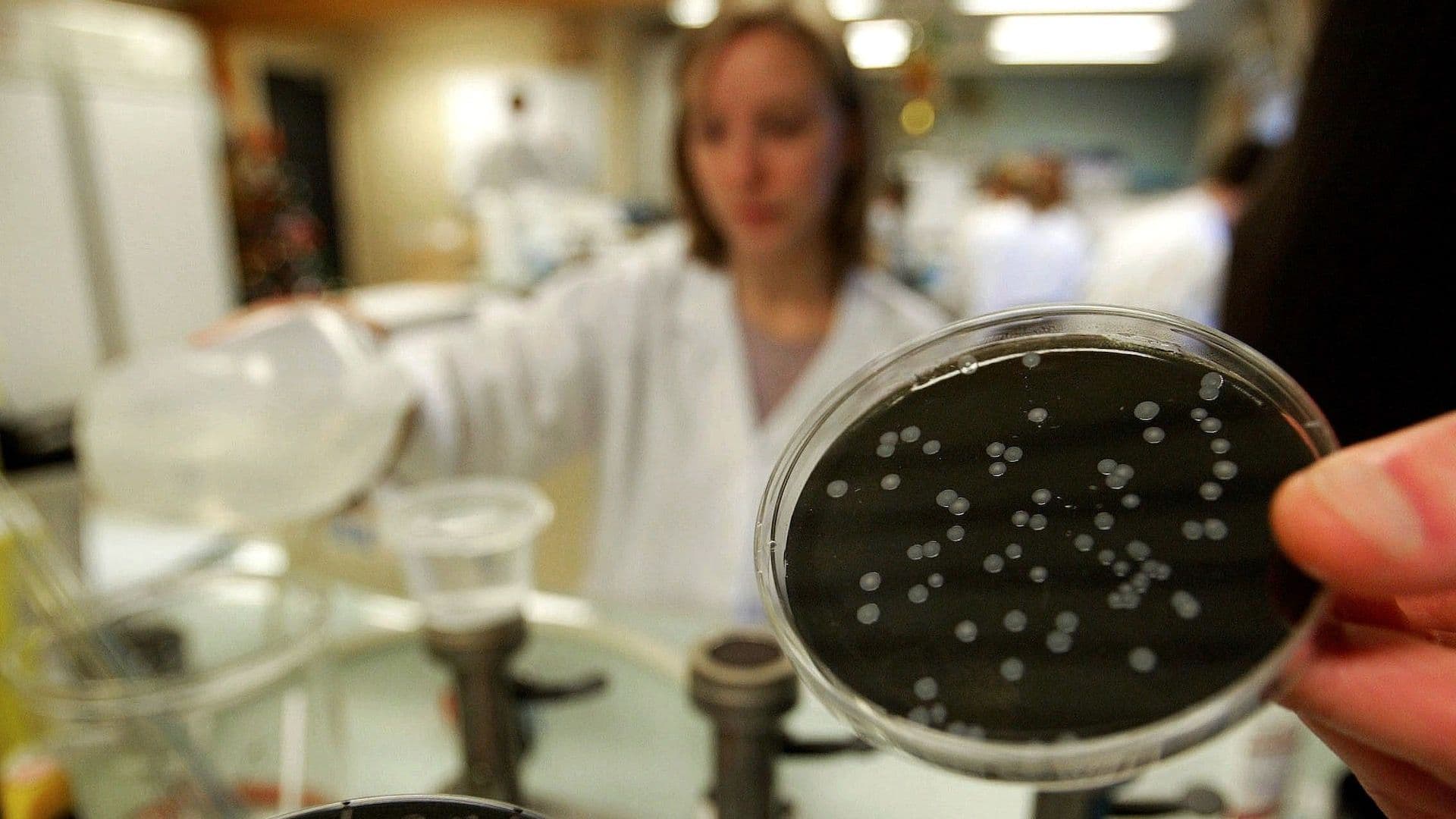 Cultivo de Legionella