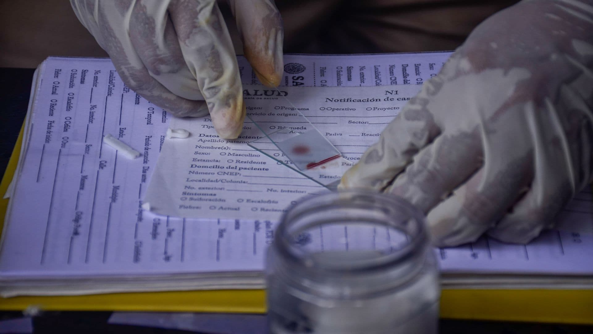 Prueba de malaria