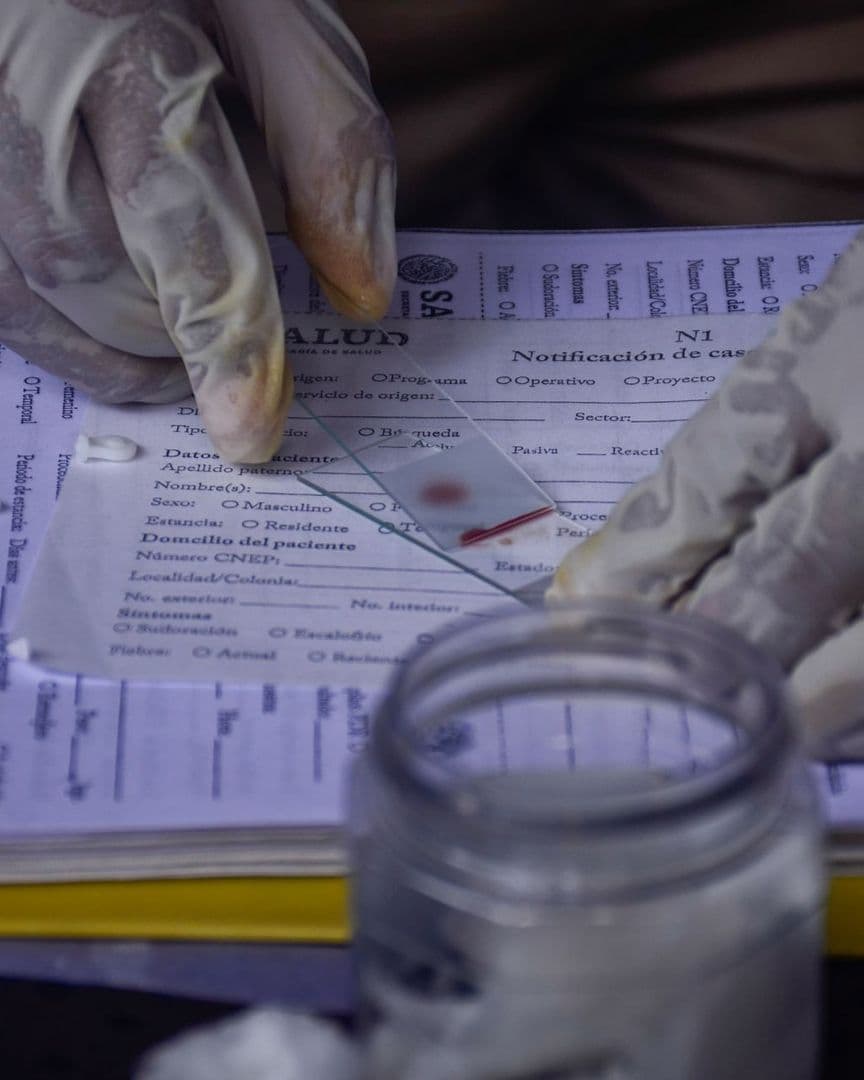 Prueba de malaria