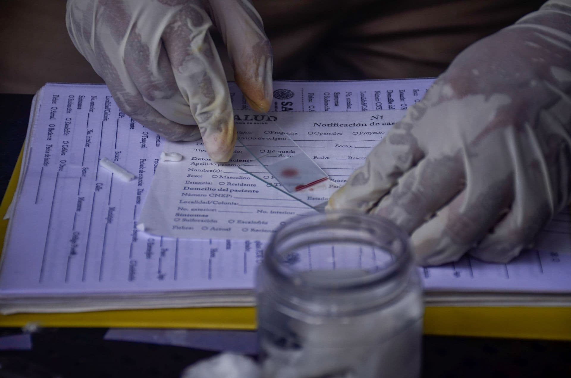 Prueba de malaria