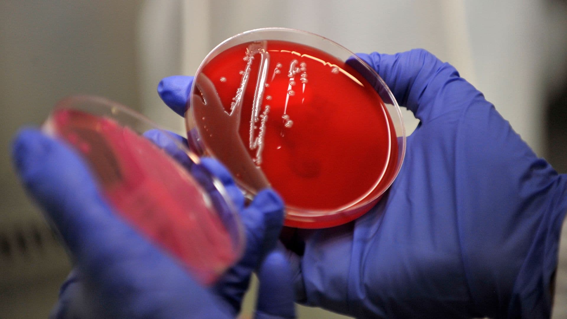 Muestra de bacteria en laboratorio de microbiología