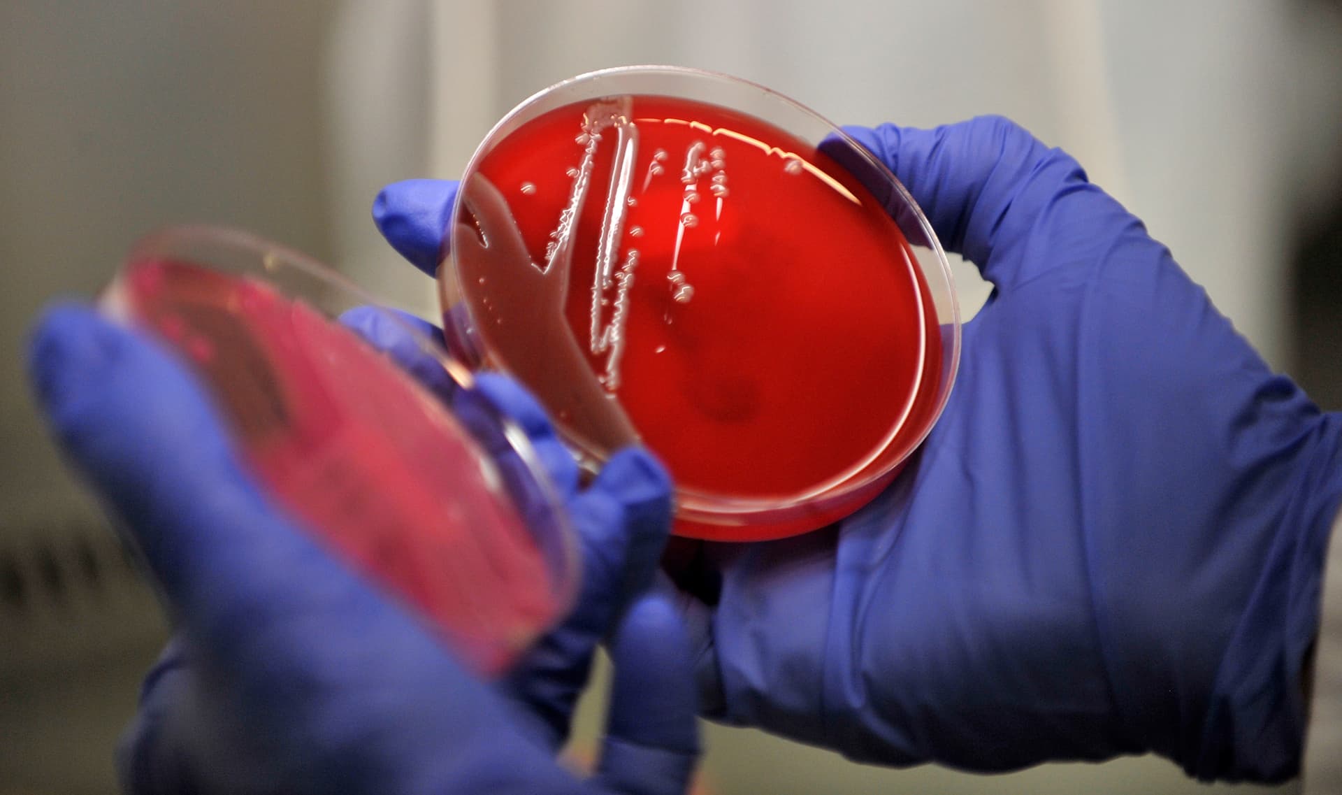 Muestra de bacteria en laboratorio de microbiología