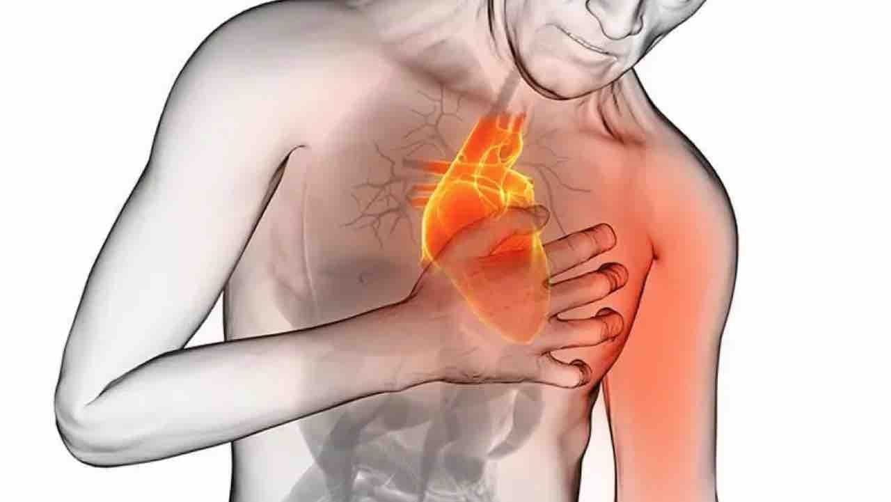 Señales de infarto se presentan al menos 30 días antes
