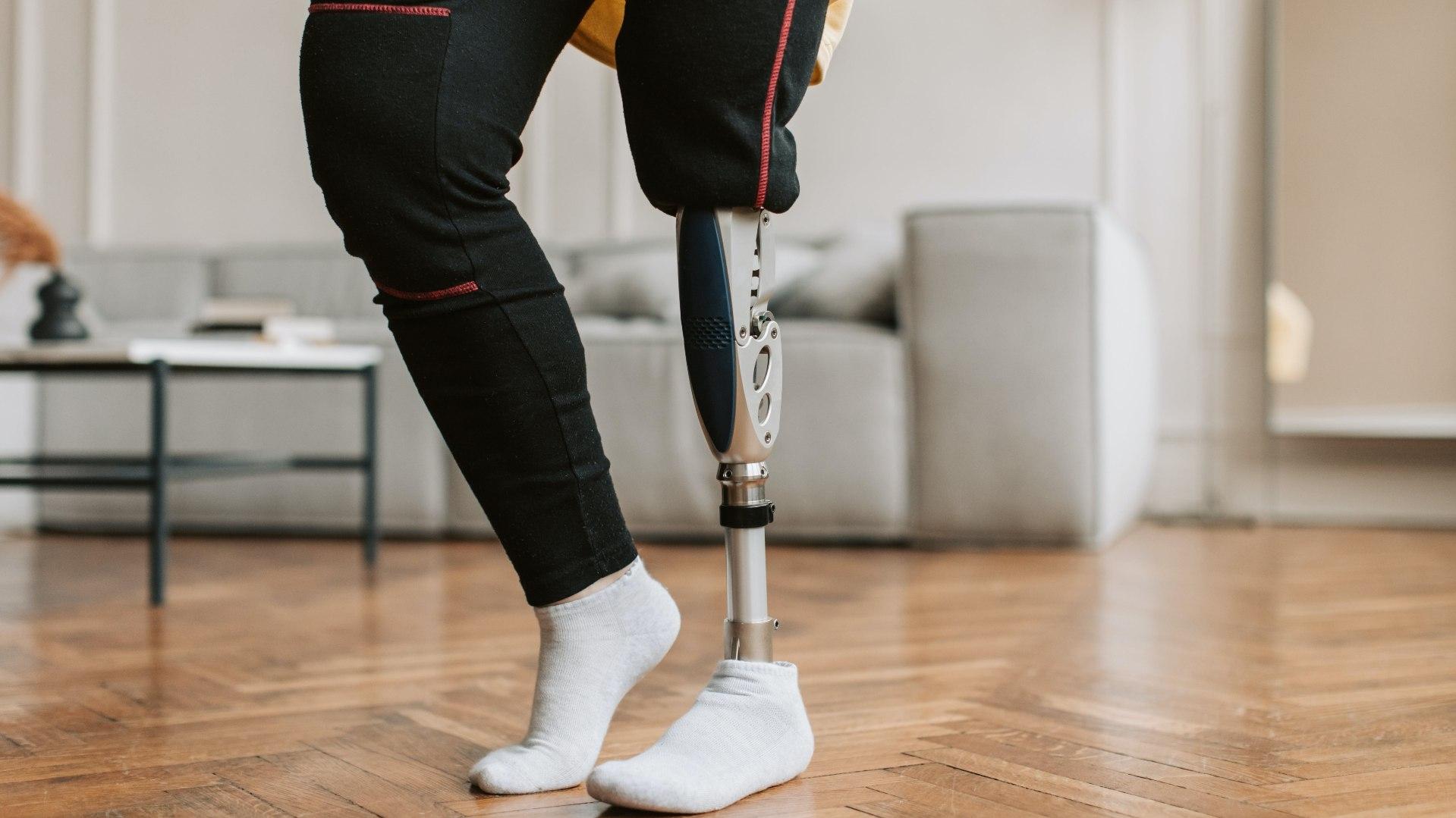 Donarán Prótesis de Piernas a Personas con Discapacidad en Tijuana