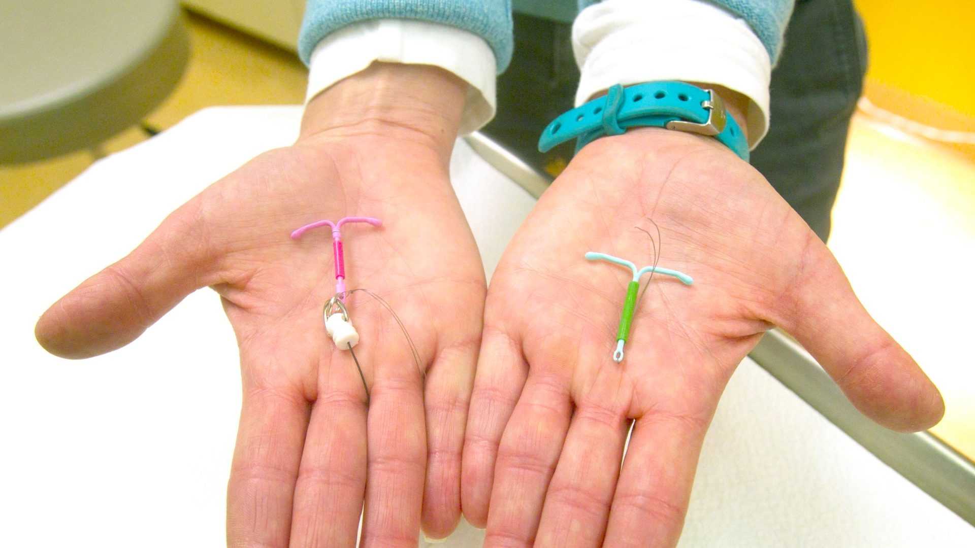 Dispositivos intrauterinos 