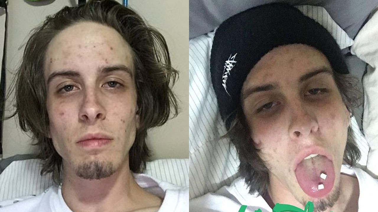 Fotos: La increíble recuperación de un adicto tras dos años de dejar las drogas