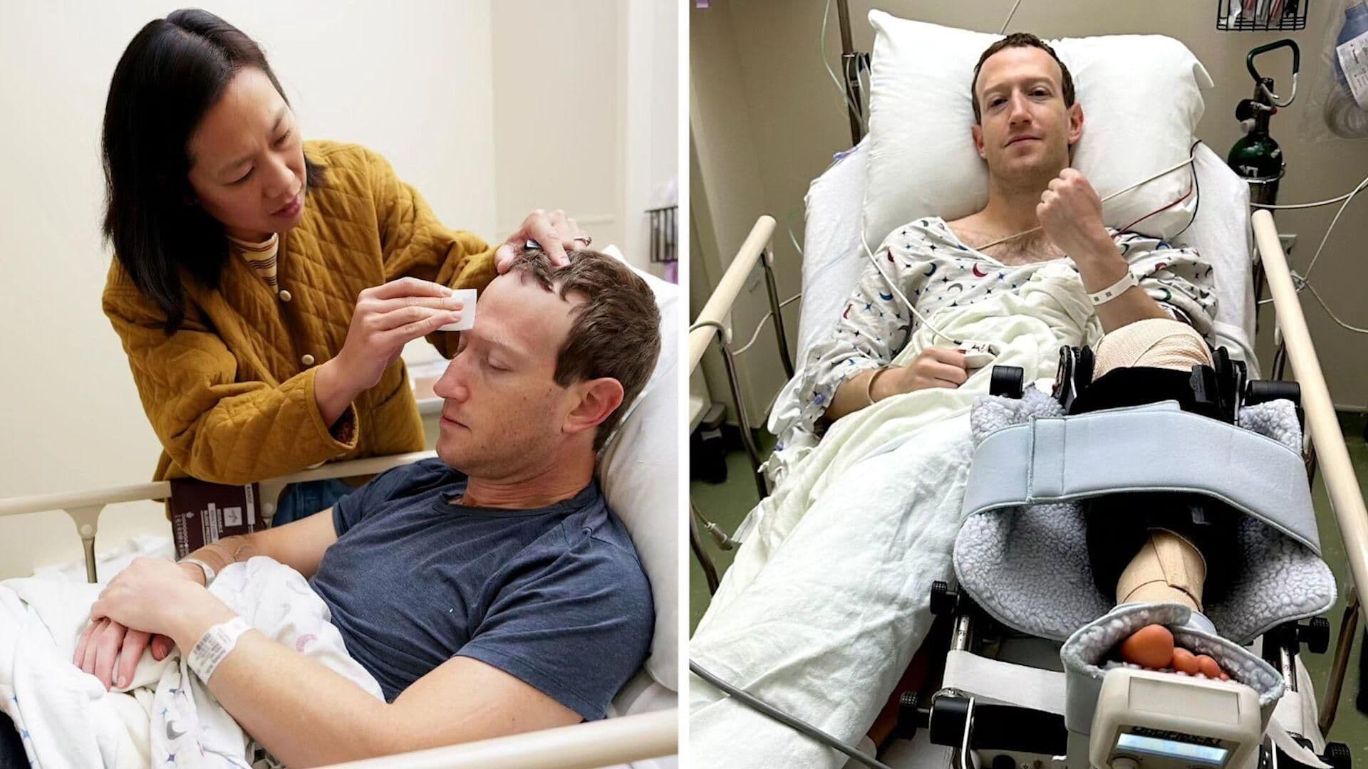 Internautas Se Alarman Tras Hospitalización de Mark Zuckerberg