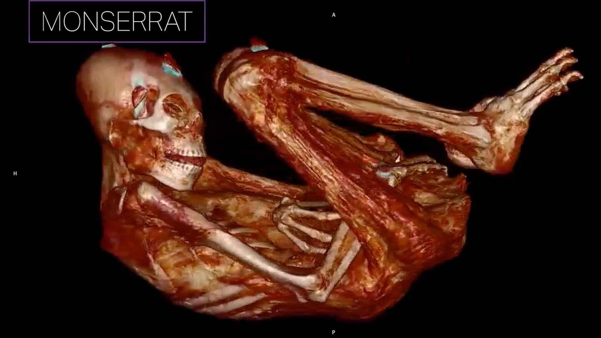 ¿Sí Son Extraterrestres? Revelan Nuevos Datos Sobre Momias de Jaime Maussan