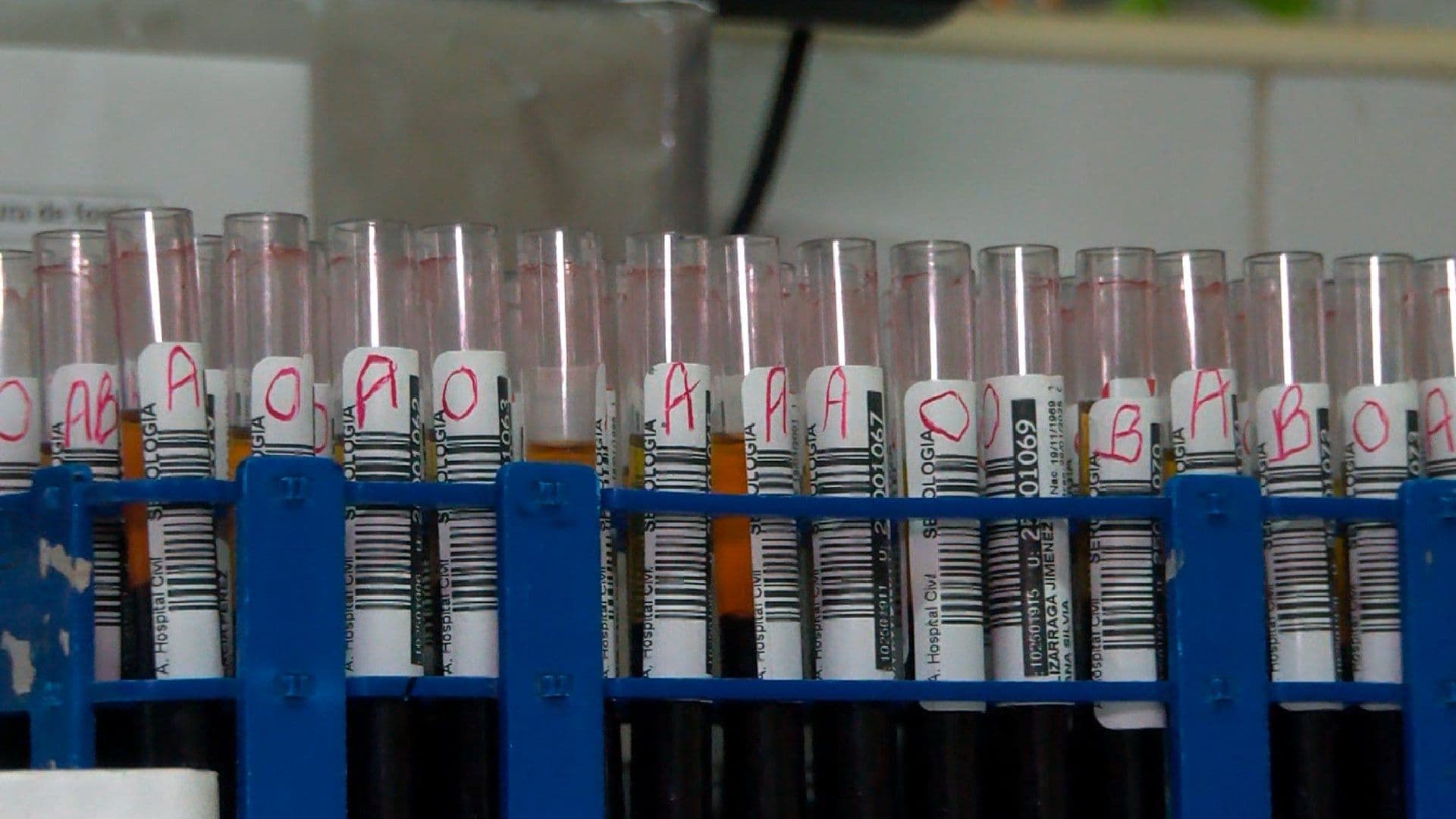 Acusan a Presunto Doctor por Brote de Hepatitis C en Tepatitlán, Jalisco