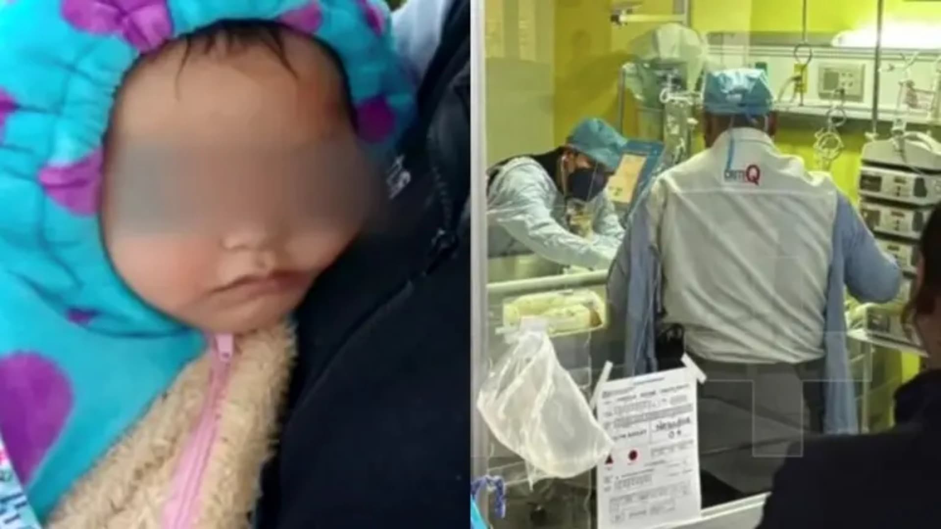 Jazlyn Azulet, Bebé de Explosión en Iztapalapa, Recibe Injertos en Manos, Piernas y Cabeza