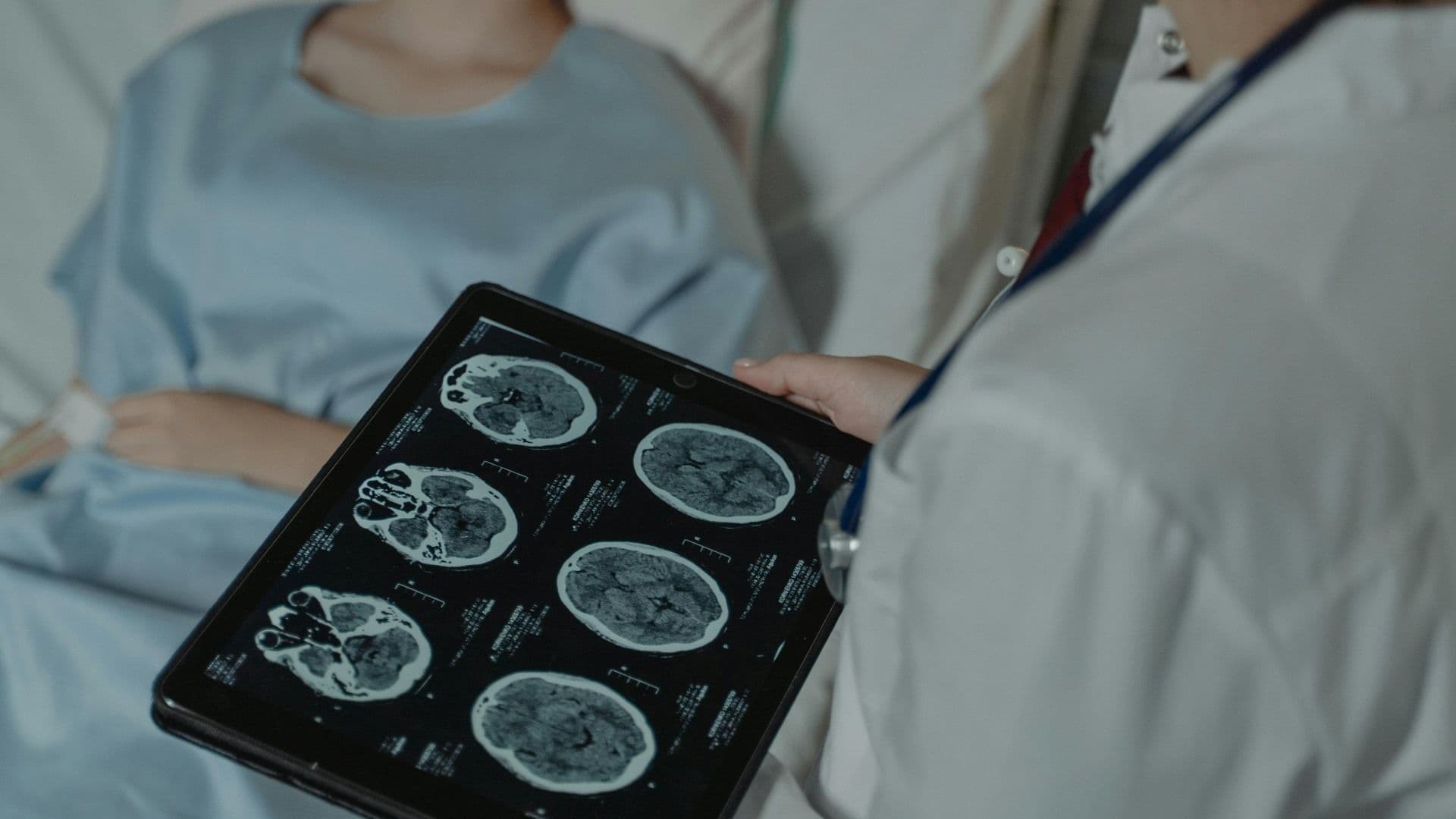 Estudios a cerebros de pacientes