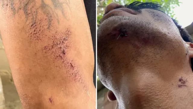 Agresión a hombre en Minatitlán