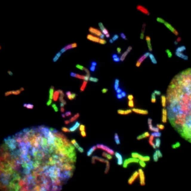 Imagen de cromosomas bajo el microscopio