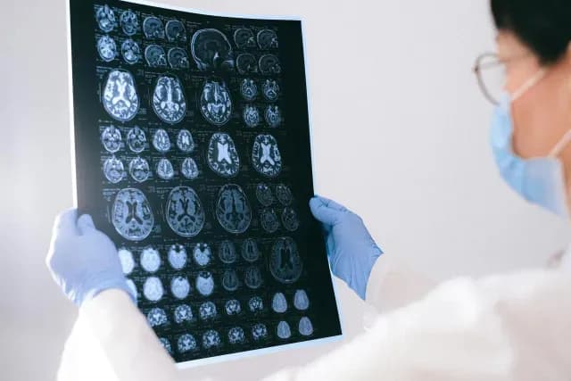 Doctora revisa una tomografía cerebral