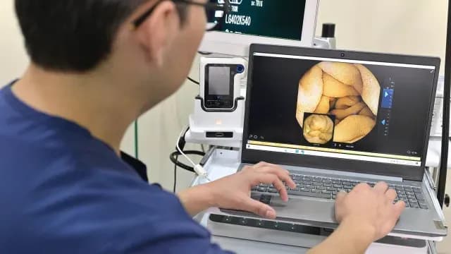 La cámara toma hasta seis fotografías por segundo del tubo digestivo. Foto. Cuartoscuro
