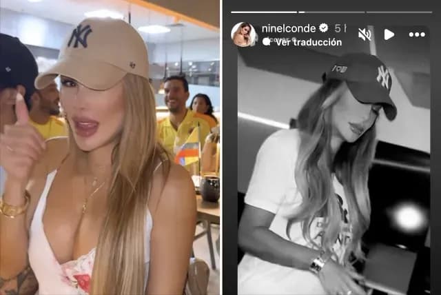 Ninel Conde preocupa a fans por posible operación en rostro